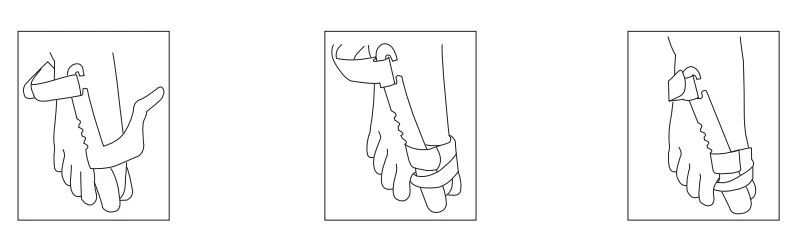 Instructions For Use Bunion Hallux Valgus Splint Instructions For Use Bunion Hallux Valgus Splint